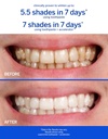 supersmile-professional-teeth-whitening--3.jpg