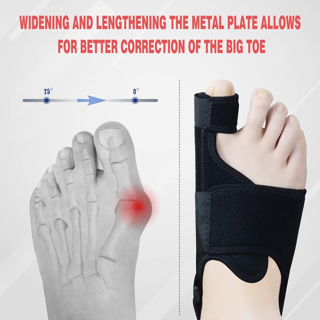 1-pair-bunion-corrector-for-women-men-ni-4.jpg