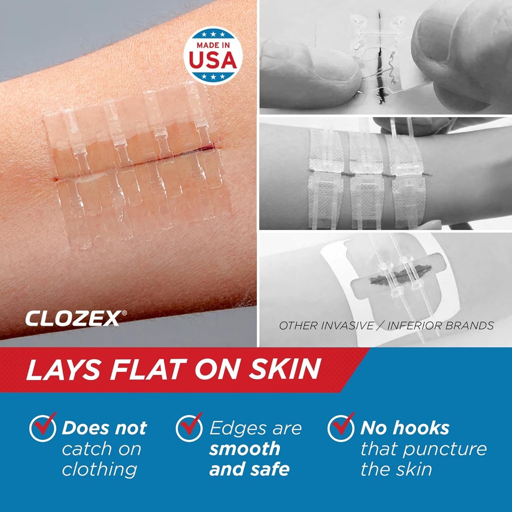 clozex-emergency-laceration-closures---r-4.jpg