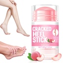 Hydrating and Anti-Cracking Foot Cream, 2025 Upgraded Moisturising Cream Relieves Severe Dryness, Intensive Repair Cream for Callused Skin on Feet, Knee, Elbow, for Men & Women ﻿ ﻿ (Peach 1PCS, Large)